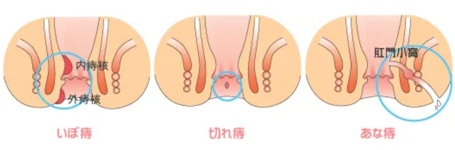 商品紹介